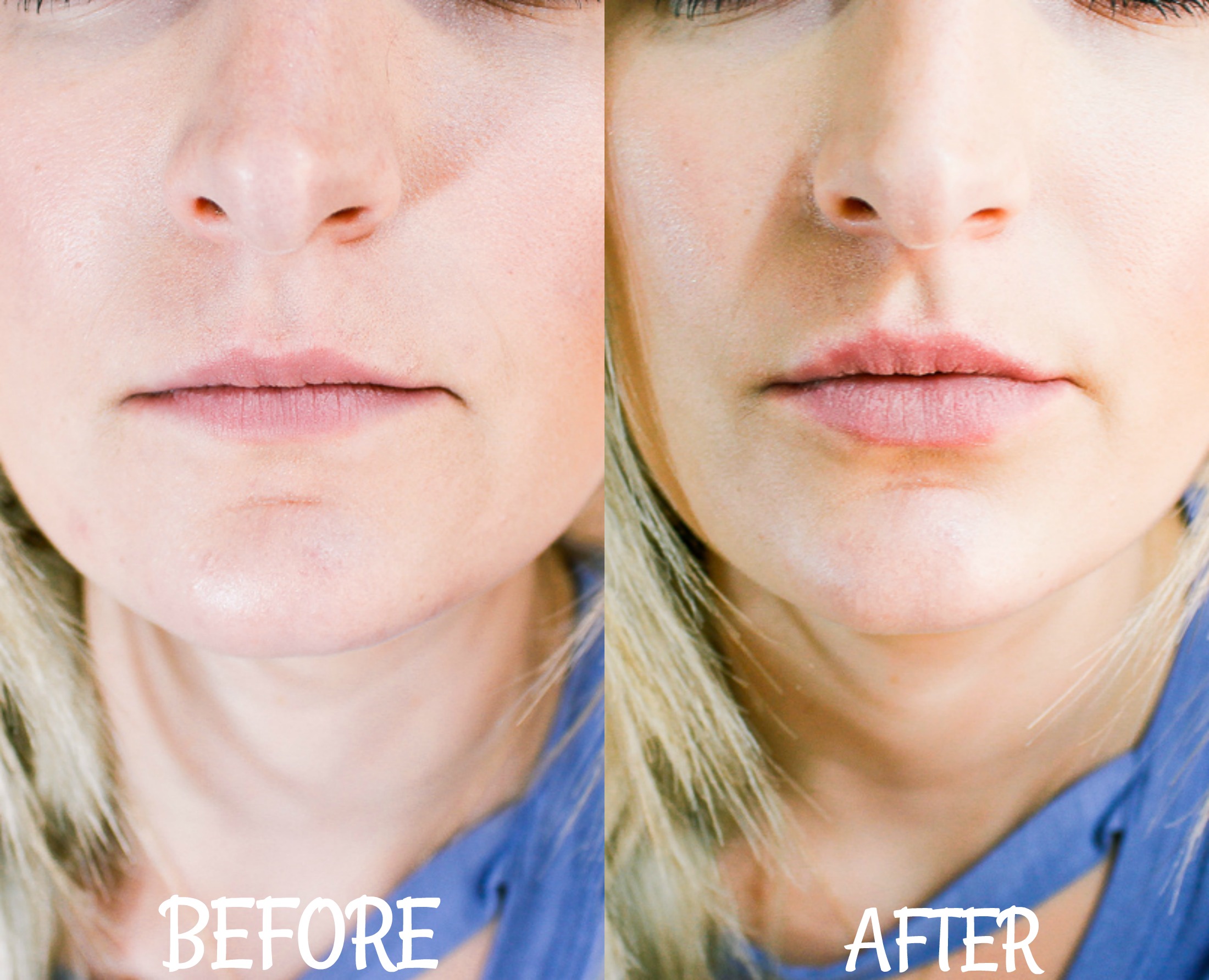 Before/After PMD Kiss Review | Audrey Madison Stowe lifestyle and fashion blogger